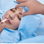 Ultrasonik Piezo Burun Estetiği