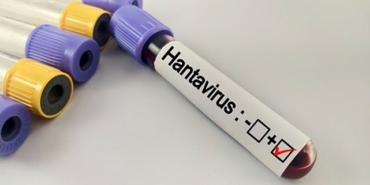 hantavirus-bir-salgina-donusur-mu.jpg